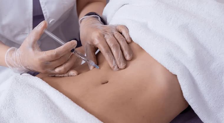 Mesoterapia