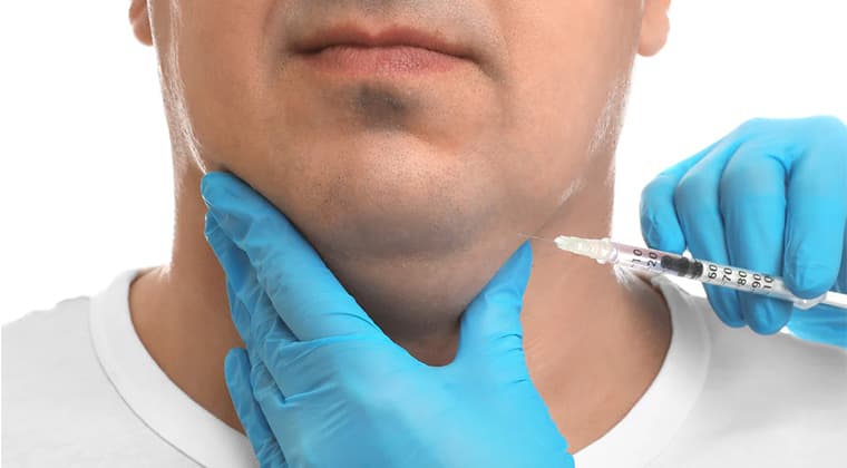 Mesoterapia en papada