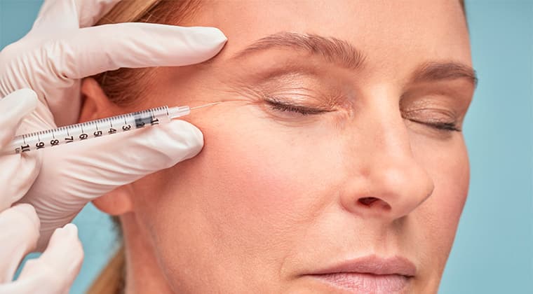 Rellenos faciales (Ácido Hialurónico, Radiesse)